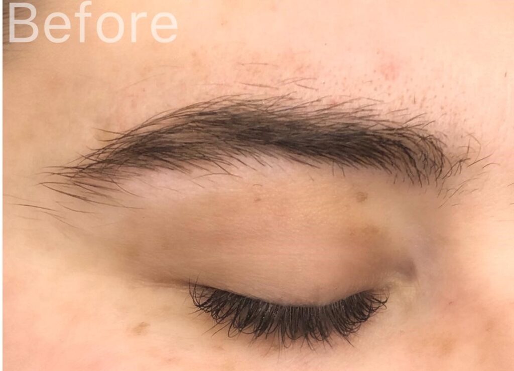 brow before